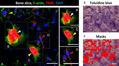 Modulation of Differentiation and Bone Resorbing Activity of Human (Pre-) Osteoclasts After X-Ray Exposure